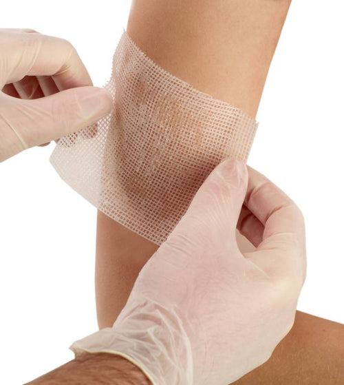 Jelonet - Vetgaasverband